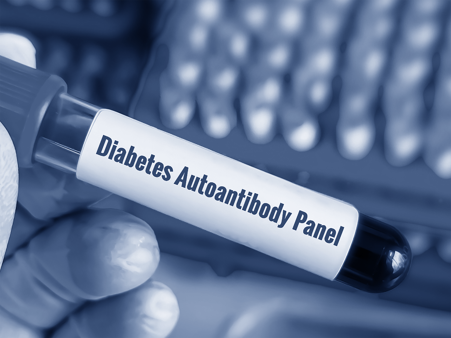 Antidiabetic — diabetes autoantibody panel